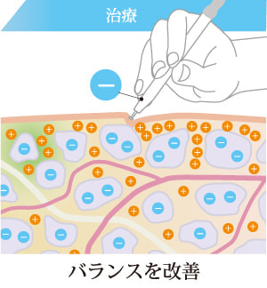 バランスを改善